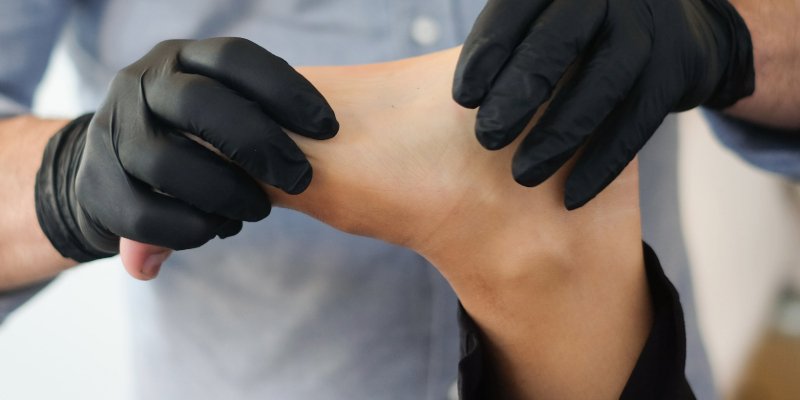 Rheumatoid Arthritis